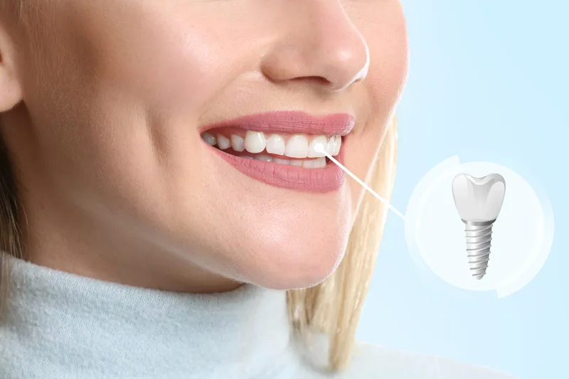 Best-Dental
