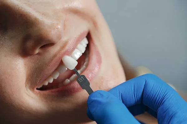 Dental