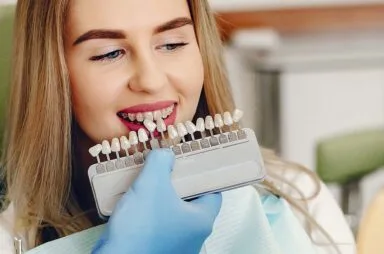 Dental-veneers