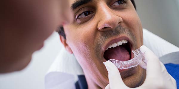 Invisalign-Treatment