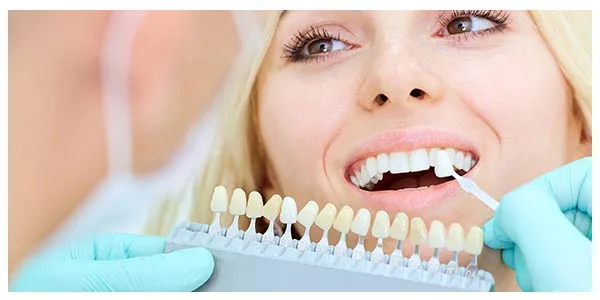 Veneers