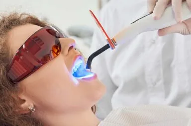 Teeth-Whitening