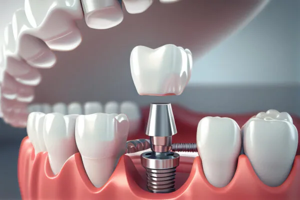 Dental