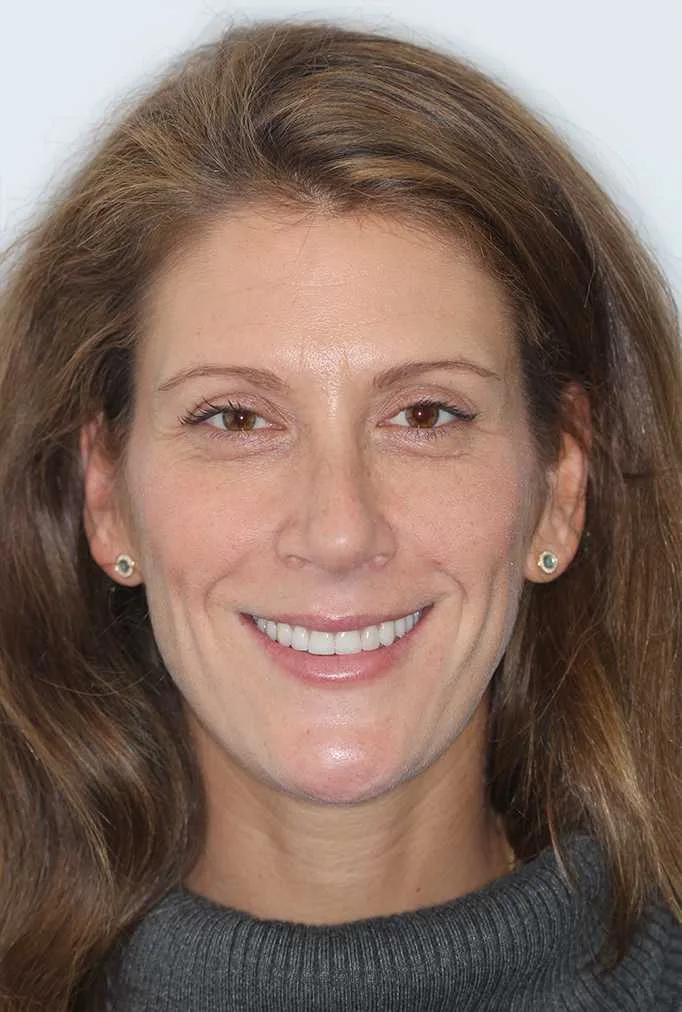 Gerri After
