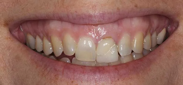 Holly Before