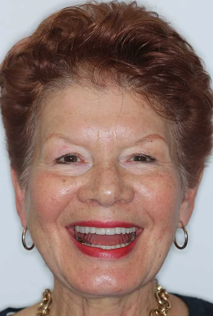 Jane After