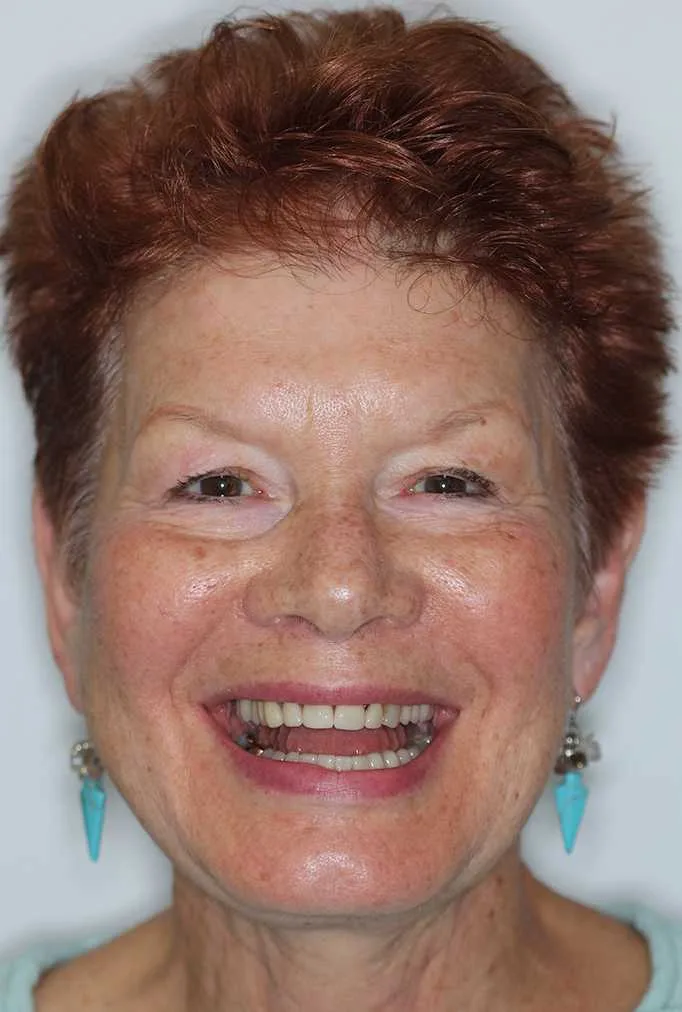 Jane Before