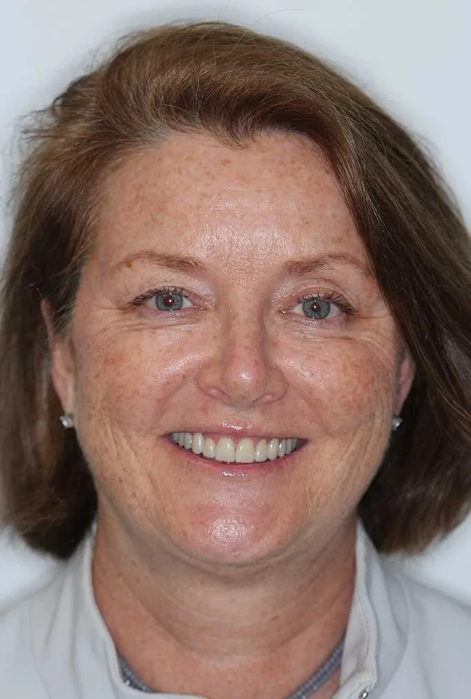 Kathleen After