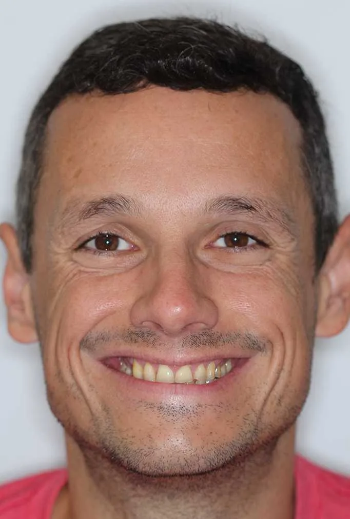 Manny Before