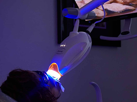 treatments-whitening