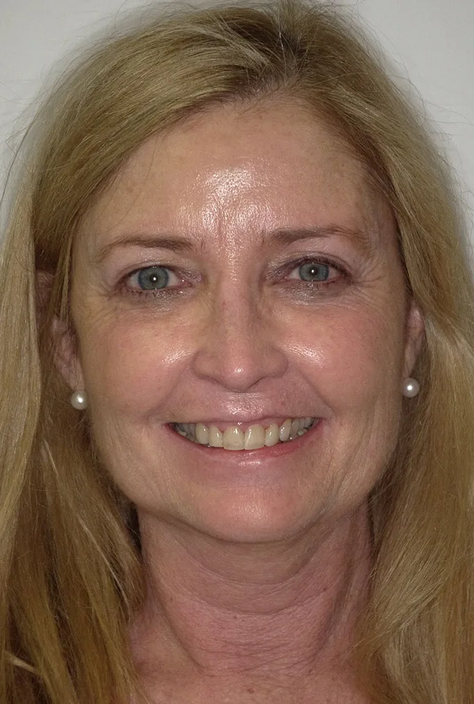 Tricia Before